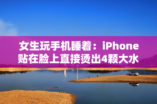 女生玩手机睡着：iPhone贴在脸上直接烫出4颗大水泡！