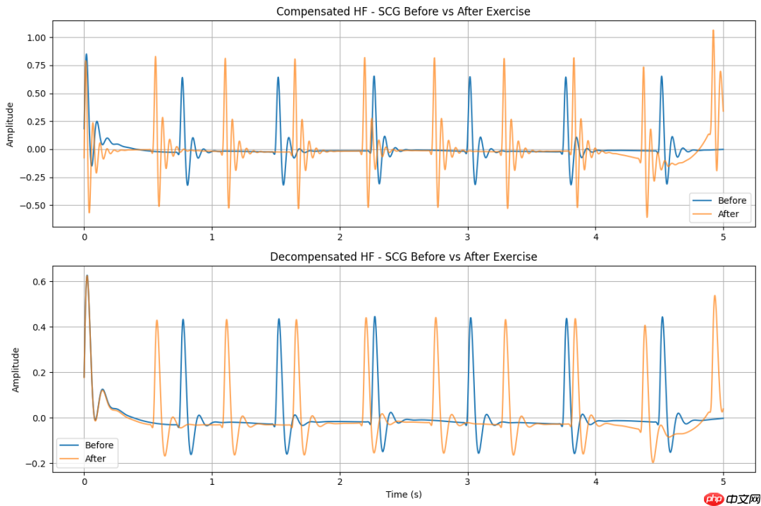 创新医疗新参数-SCG（心震图）：详细解读版