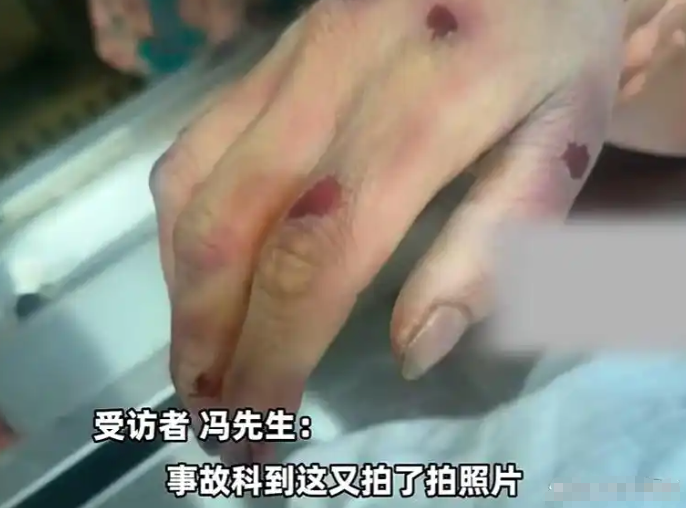 悲剧！河北女子骑车被狗撞倒身亡，主人为躲赔偿将狗打死 - php中文网