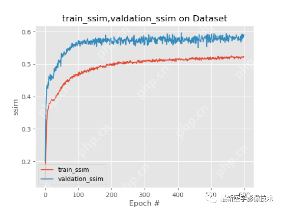 USenhance2023——2023 年超声图像增强挑战赛