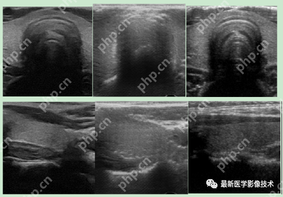 USenhance2023——2023 年超声图像增强挑战赛