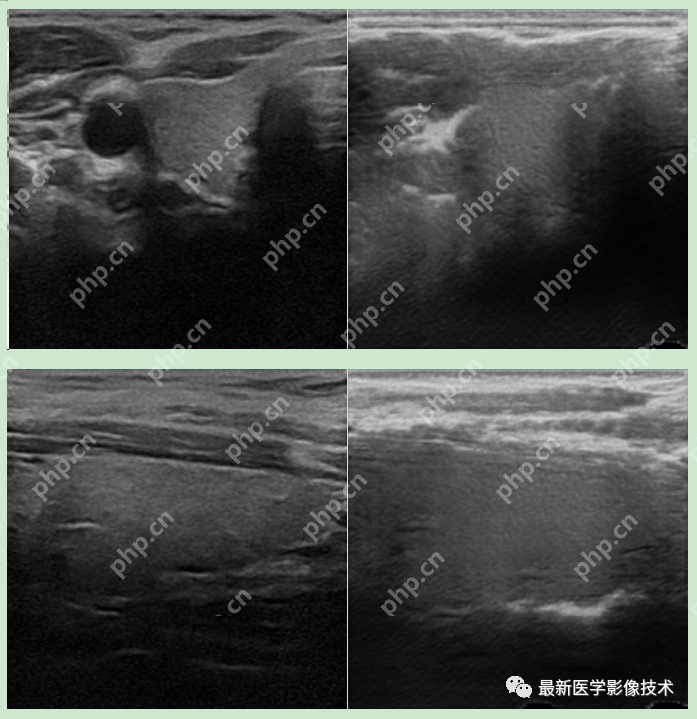 USenhance2023——2023 年超声图像增强挑战赛
