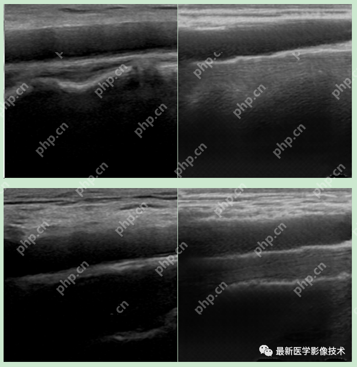 USenhance2023——2023 年超声图像增强挑战赛