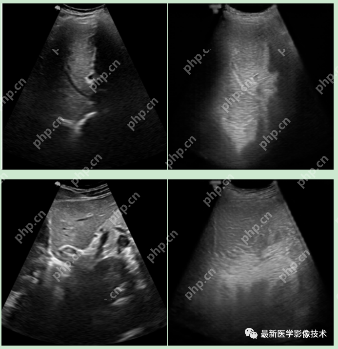 USenhance2023——2023 年超声图像增强挑战赛